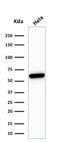 Heat Shock Protein Family D (Hsp60) Member 1 antibody, GTX34788, GeneTex, Western Blot image 
