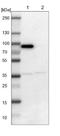 Leucine Rich Repeats And Calponin Homology Domain Containing 3 antibody, NBP1-81083, Novus Biologicals, Western Blot image 