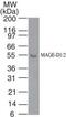 Melanoma-associated antigen D1 antibody, PA5-23347, Invitrogen Antibodies, Western Blot image 