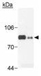 Ribonuclease L antibody, GTX30638, GeneTex, Western Blot image 