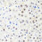 RNA Polymerase II Subunit B antibody, LS-C334391, Lifespan Biosciences, Immunohistochemistry paraffin image 
