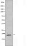 Ribosomal Protein S11 antibody, orb226209, Biorbyt, Western Blot image 