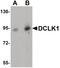 Serine/threonine-protein kinase DCLK1 antibody, PA5-20908, Invitrogen Antibodies, Western Blot image 