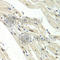 UPF1 RNA Helicase And ATPase antibody, A1521, ABclonal Technology, Immunohistochemistry paraffin image 