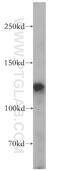 Fas Binding Factor 1 antibody, 11531-1-AP, Proteintech Group, Western Blot image 