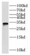 Ribosomal Protein L8 antibody, FNab07445, FineTest, Western Blot image 