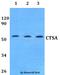 Lysosomal protective protein antibody, A02440, Boster Biological Technology, Western Blot image 