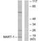 MART1 antibody, A02033, Boster Biological Technology, Western Blot image 