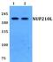 Nucleoporin 210 Like antibody, PA5-75817, Invitrogen Antibodies, Western Blot image 
