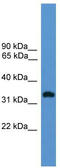 Olfactory Receptor Family 1 Subfamily L Member 8 antibody, TA342701, Origene, Western Blot image 
