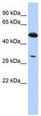 Phosphoinositide-3-Kinase Interacting Protein 1 antibody, TA342066, Origene, Western Blot image 