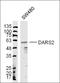 Aspartyl-tRNA synthetase, mitochondrial antibody, orb182984, Biorbyt, Western Blot image 