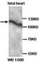 Adenylate Cyclase 6 antibody, orb77016, Biorbyt, Western Blot image 