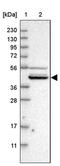Solute carrier organic anion transporter family member 2B1 antibody, PA5-54258, Invitrogen Antibodies, Western Blot image 