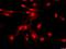 SETX antibody, PA5-72986, Invitrogen Antibodies, Immunofluorescence image 