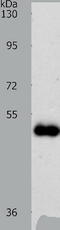 Zinc transporter ZIP6 antibody, TA323254, Origene, Western Blot image 