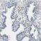 Solute carrier family 45 member 3 antibody, NBP1-89630, Novus Biologicals, Immunohistochemistry frozen image 