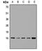 Vesicle Associated Membrane Protein 4 antibody, LS-C668686, Lifespan Biosciences, Western Blot image 