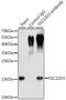 TSC22 Domain Family Member 3 antibody, GTX33560, GeneTex, Immunoprecipitation image 