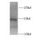 Promotilin antibody, FNab05219, FineTest, Western Blot image 