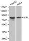 Alkaline Phosphatase, Biomineralization Associated antibody, PA5-75921, Invitrogen Antibodies, Western Blot image 