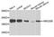 SWI/SNF-related matrix-associated actin-dependent regulator of chromatin subfamily E member 1-related antibody, A4408, ABclonal Technology, Western Blot image 