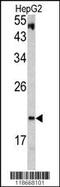 Von Hippel-Lindau Tumor Suppressor antibody, 62-318, ProSci, Western Blot image 