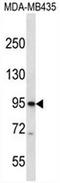 Cyclic Nucleotide Gated Channel Beta 3 antibody, AP50985PU-N, Origene, Western Blot image 
