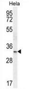 Homeobox protein Nkx-2.1 antibody, AP52891PU-N, Origene, Western Blot image 