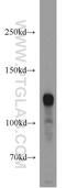 Phosphodiesterase 4A antibody, 16226-1-AP, Proteintech Group, Western Blot image 