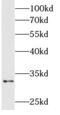 AlkB Homolog 4, Lysine Demethylase antibody, FNab00313, FineTest, Western Blot image 
