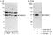 Proteasome 26S Subunit, Non-ATPase 12 antibody, A303-829A, Bethyl Labs, Immunoprecipitation image 
