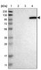 Unc-45 Myosin Chaperone B antibody, NBP1-84426, Novus Biologicals, Western Blot image 