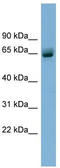 Schlafen Family Member 12 antibody, TA344938, Origene, Western Blot image 