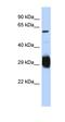 Histone-lysine N-methyltransferase SETMAR antibody, orb330629, Biorbyt, Western Blot image 