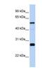 Family With Sequence Similarity 83 Member F antibody, NBP1-79504, Novus Biologicals, Western Blot image 