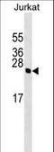 High Mobility Group Box 4 antibody, LS-C159850, Lifespan Biosciences, Western Blot image 