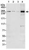 Centrosomal Protein 290 antibody, ab85728, Abcam, Western Blot image 