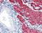 Transgelin antibody, orb88286, Biorbyt, Immunohistochemistry paraffin image 