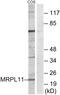 Mitochondrial Ribosomal Protein L11 antibody, GTX87823, GeneTex, Western Blot image 