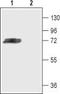 Potassium Voltage-Gated Channel Subfamily D Member 3 antibody, TA328633, Origene, Western Blot image 