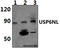 USP6 N-Terminal Like antibody, A09295-1, Boster Biological Technology, Western Blot image 