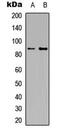 Interleukin 4 Receptor antibody, MBS8216748, MyBioSource, Western Blot image 
