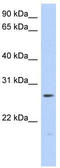 Methenyltetrahydrofolate Synthetase antibody, TA340111, Origene, Western Blot image 