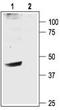 Potassium Voltage-Gated Channel Subfamily J Member 6 antibody, TA328926, Origene, Western Blot image 