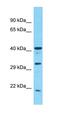 Elongin BC And Polycomb Repressive Complex 2 Associated Protein antibody, orb327159, Biorbyt, Western Blot image 