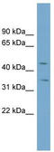 Solute Carrier Family 39 Member 8 antibody, TA333707, Origene, Western Blot image 