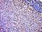Chromosome 1 Open Reading Frame 158 antibody, orb182479, Biorbyt, Immunohistochemistry paraffin image 