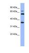 Cytochrome P450 Family 2 Subfamily B Member 6 antibody, NBP1-57978, Novus Biologicals, Western Blot image 
