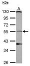 Dopamine Receptor D1 antibody, GTX100355, GeneTex, Western Blot image 
